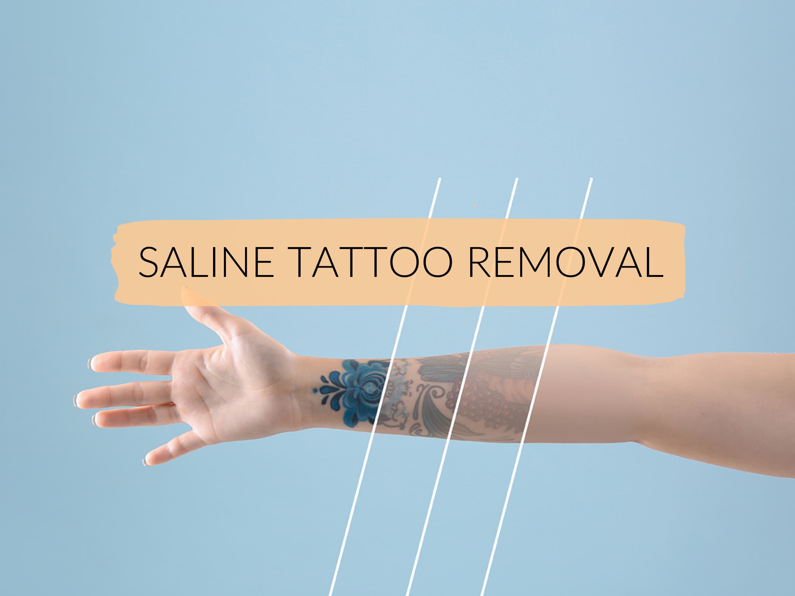 Saline Tattoo Removal  Bespoke Beauty and Brows